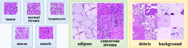 Mitigating open-set misclassification in a colorectal cancer detecting neural network