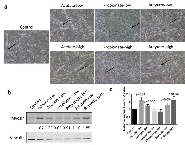 Investigating the impact of short-chain fatty acids on myofiber dynamics and insulin sensitivity