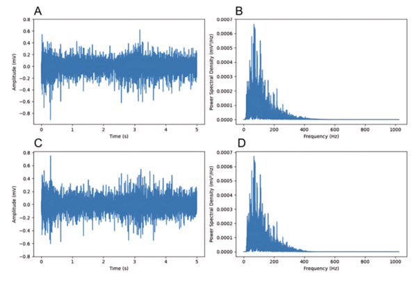 Feature extraction from peak detection algorithms for enhanced EMG-based hand gesture recognition models