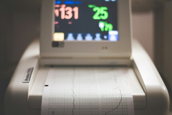 Leveraging transfer learning with convolutional neural networks for cardiovascular disease detection