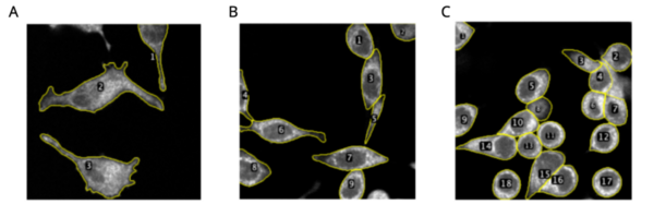 Cover photo for Investigating the effects of glucose reintroduction on acutely starved HeLa cells