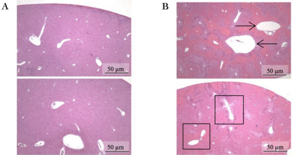 Cover photo for Evaluation of hepatotoxicity from excessive acetaminophen: physiological and histological changes