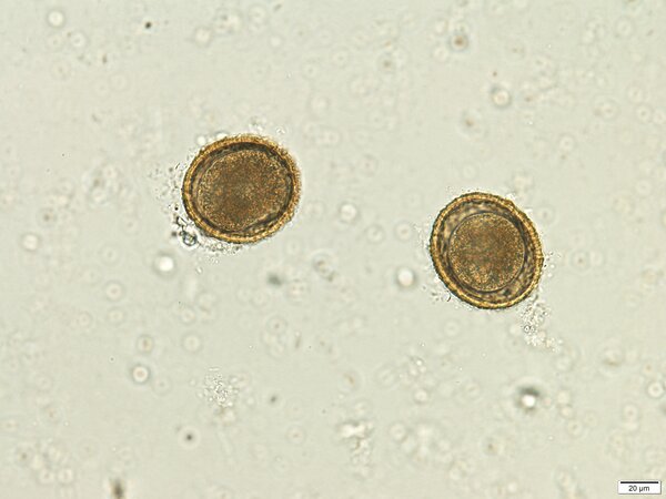 Cover photo for The Prevalence of Brain-Eating Roundworm <i>Baylisascaris procyonis</i> in Merrick County, Nebraska