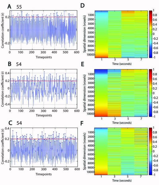 Cover photo for Studying the effects of different anesthetics on quasi-periodic patterns in rat fMRI