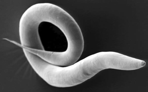 Cover photo for The Effect of Different Fructose Diets on the Lifespan of <em>C. elegans</em>