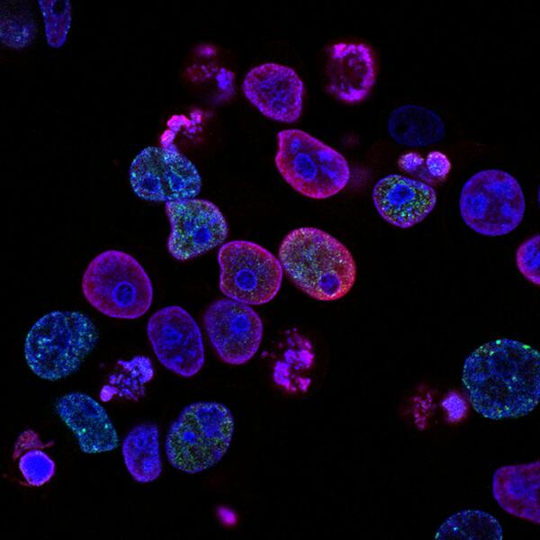 Cover photo for Reducing PMA-induced <em>COX-2</em> expression using a herbal formulation in MCF-7 breast cancer cells