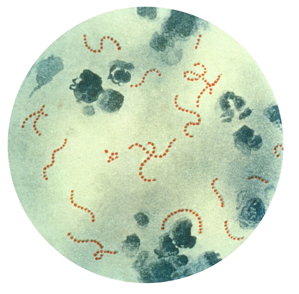 Cover photo for The Development of a Highly Sensitive Home Diagnosis Kit for Group A Streptococcus Bacteria (GAS)