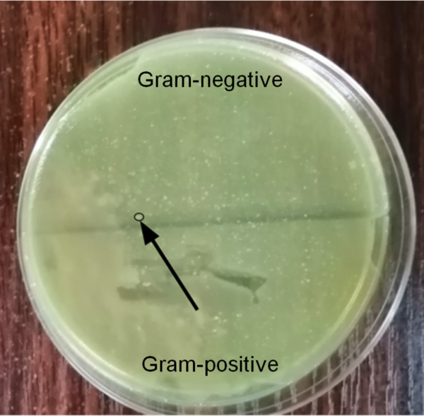 Cover photo for Effect of Gram-positive bacteria on antibiotic resistance in Gram-negative bacteria