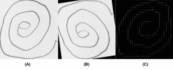 Cover photo for A HOG feature extraction and CNN approach to Parkinson’s spiral drawing diagnosis