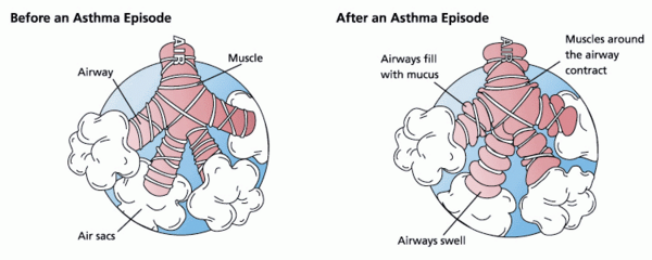Cover photo for <em>Pichia kudriavzevii</em> Yeast Exposure Increases the Asthmatic Behavior of Alveolar Epithelial Cells <em>In Vitro</em>