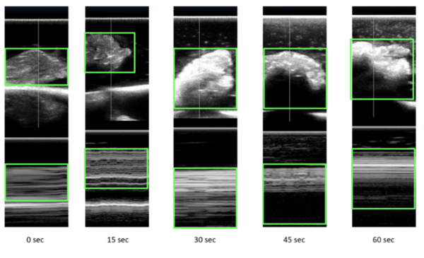 Cover photo for Identification of microwave-related changes in tissue using an ultrasound scan